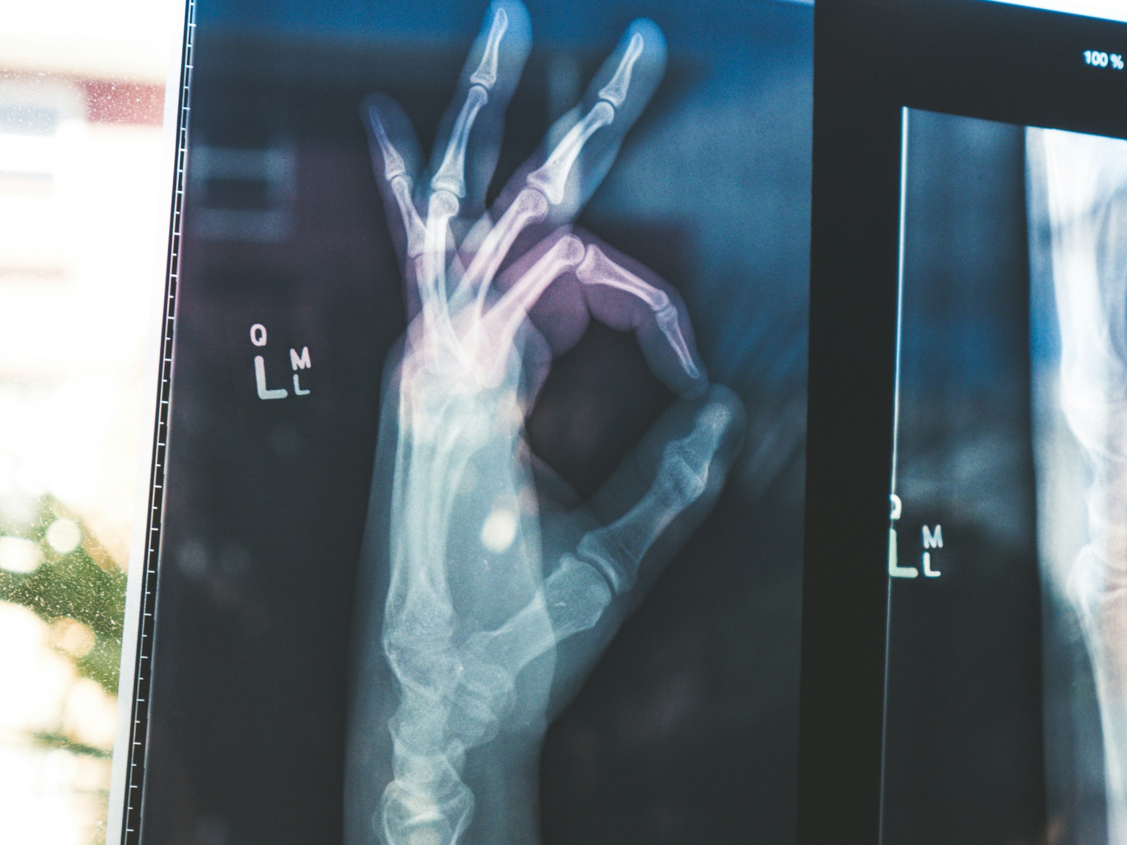 Google’s open MedGemma AI models could transform healthcare